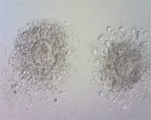 三代试管婴儿指南：了解价格影响因素与助孕全过程