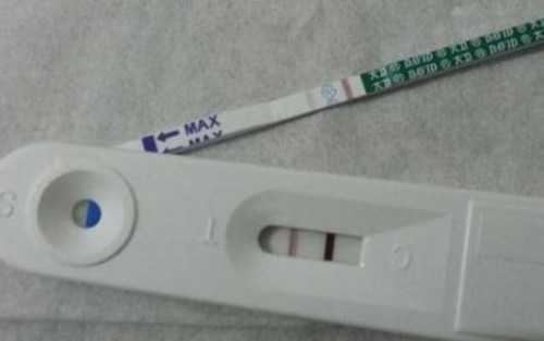 深圳辅助生殖：北大医院第三代试管染色体筛查费用与优势解析