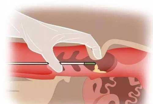 深圳辅助生殖新规：2026年试管助孕办理需结婚证，流程与注意事项解析